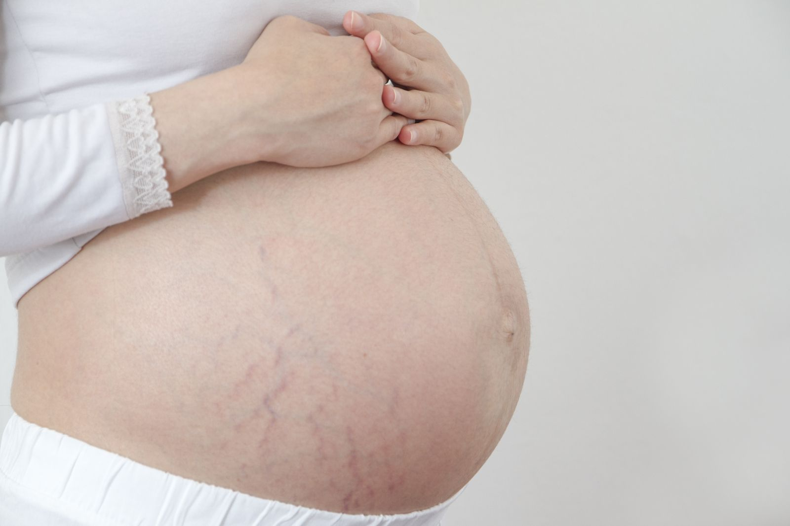 chống rạn da trong thai kỳ